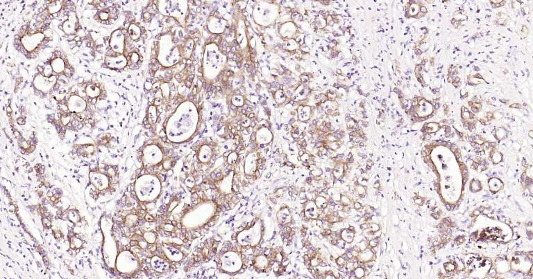 人细胞角蛋白18即用型免疫组化试剂盒-IHC0249H